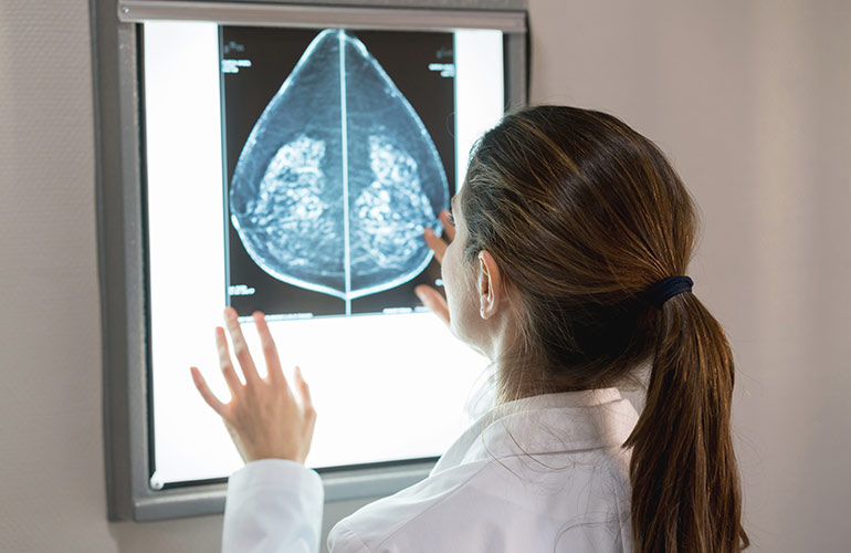 Mammograms
