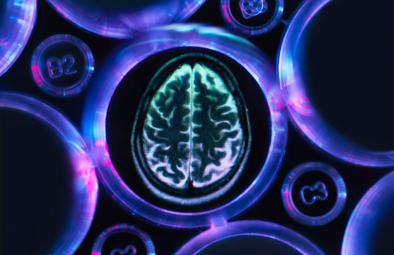 15. Alzheimer’s is a woman’s issue
