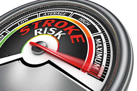 6 Signs of Stroke You Might be Ignoring