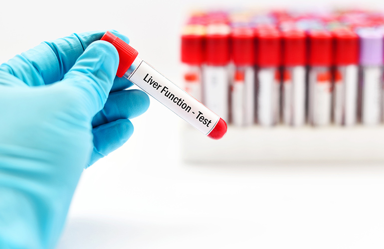Skipping liver function tests