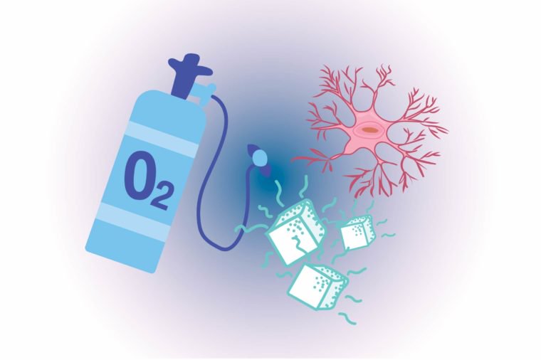 Brain cells can only survive on oxygen and glucose