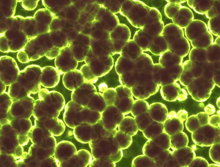 3. Consider a pro-biotic