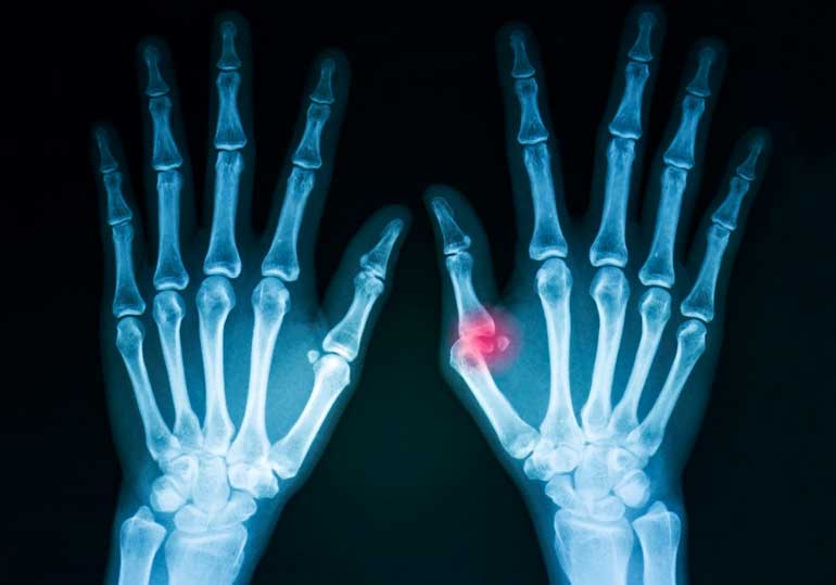 5. Nintendo thumb