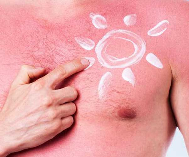 7. Remember the sly spots