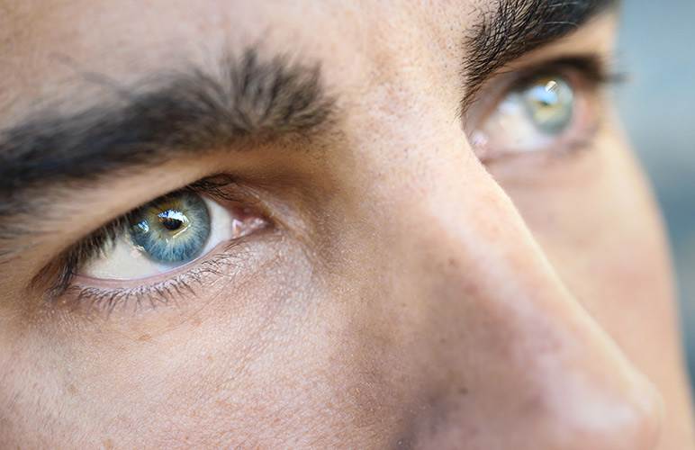 Glabella