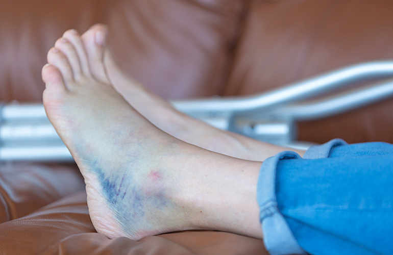 Acute inflammation