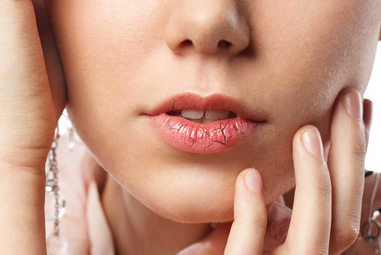 Dry, flaky skin or lips