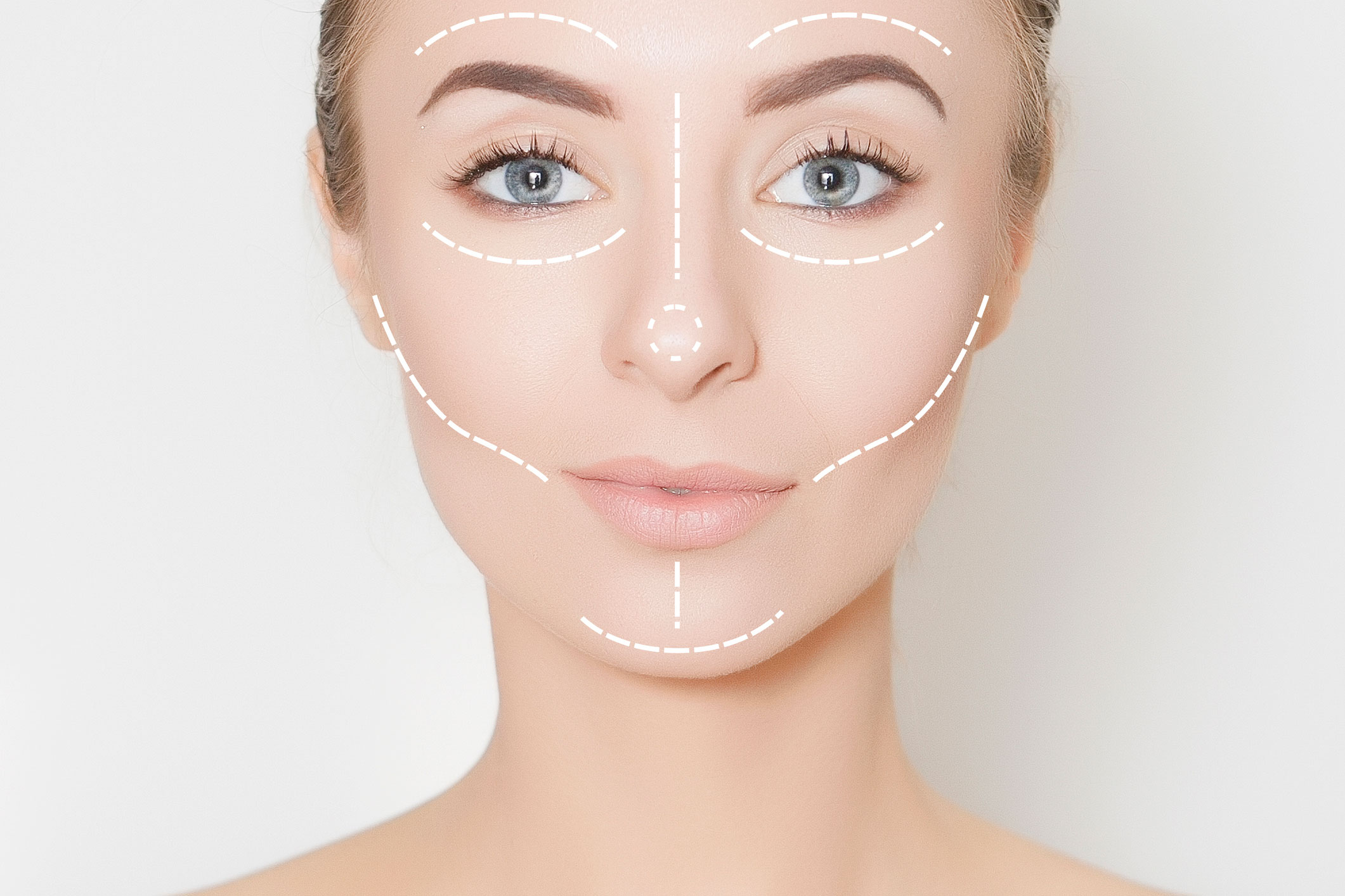 Facial asymmetry