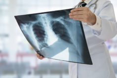 12 silent signs your lungs could be in trouble