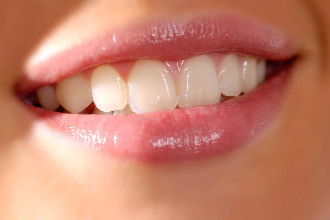 Whiten teeth on the cheap