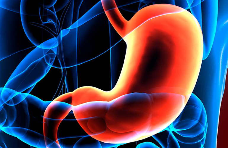 Stomach cancer: Types A and AB increases risk