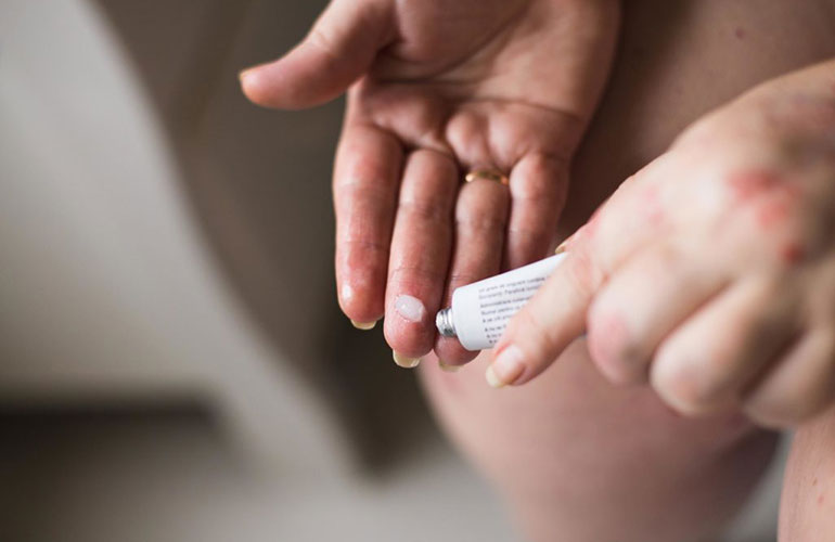 Home remedies for back pain: try a rub
