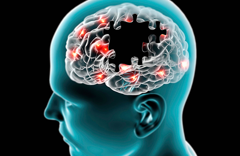 Dementia and memory loss: Type AB increases risk