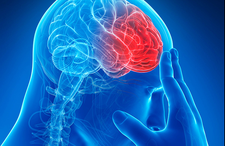 Stroke: Type O has the lowest risk