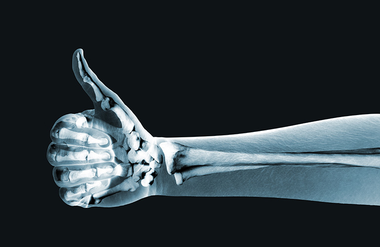 Build strong bones