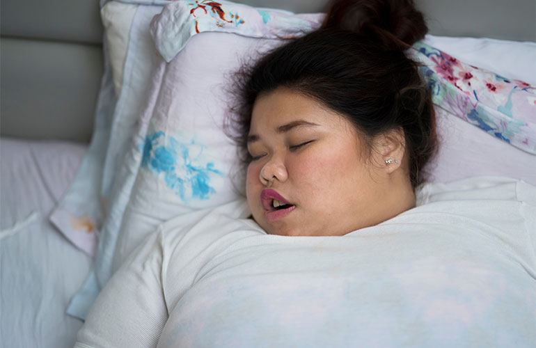 Watch out for obstructive sleep apnoea
