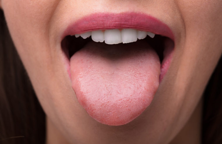 True or false: A person having a seizure is at risk of swallowing his or her tongue