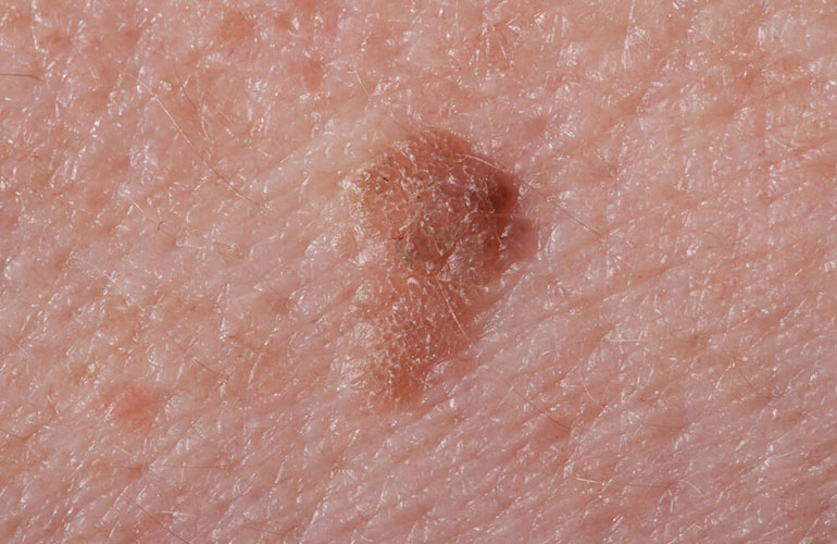 You have brown spots that aren’t from the sun