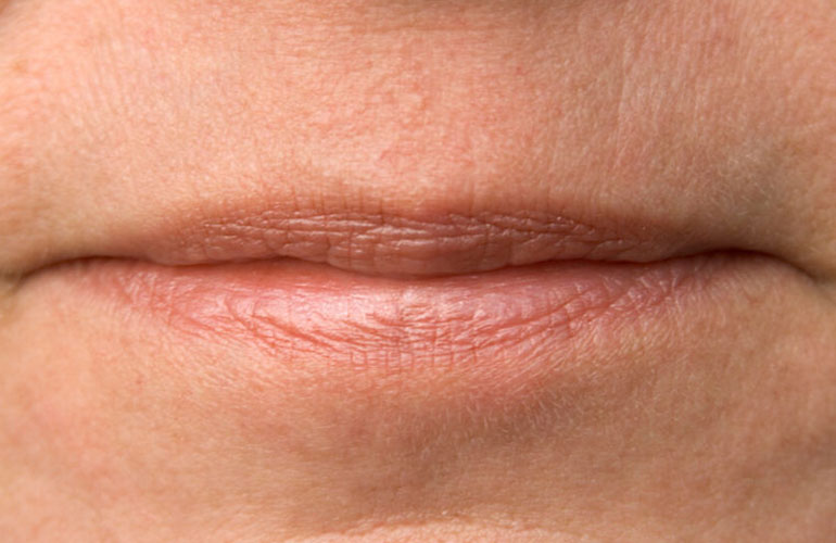 Your lips are thinning out