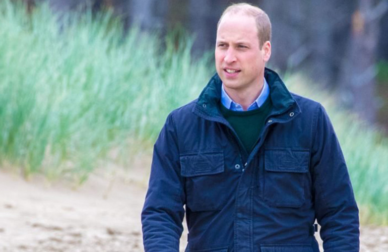 He’s been bullied for his hair loss