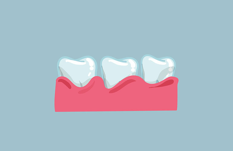 Red or swollen gums