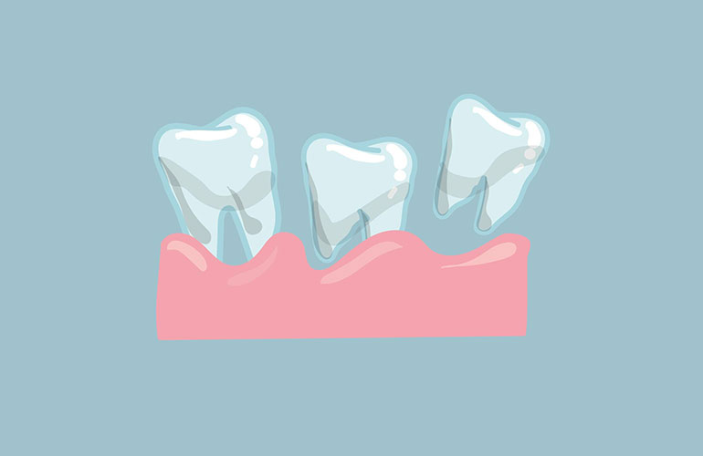 Wiggly teeth