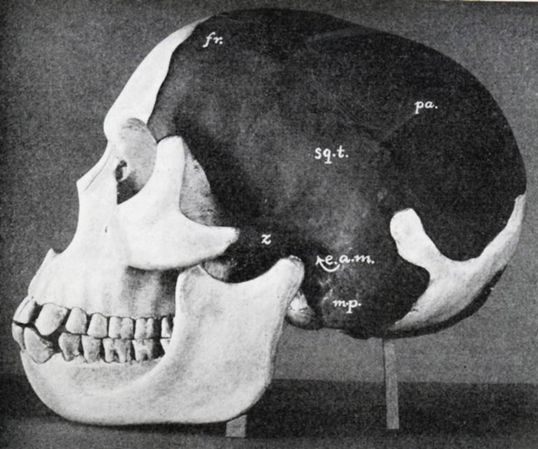 Piltdown Man