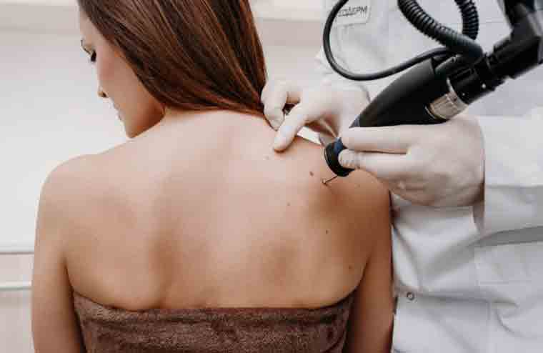 Skin conditions
