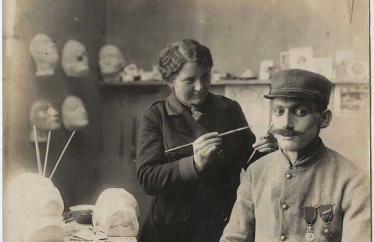 Plastic surgery