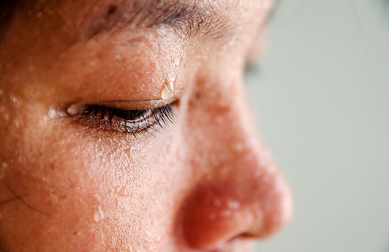 Try Botox for excessive sweating