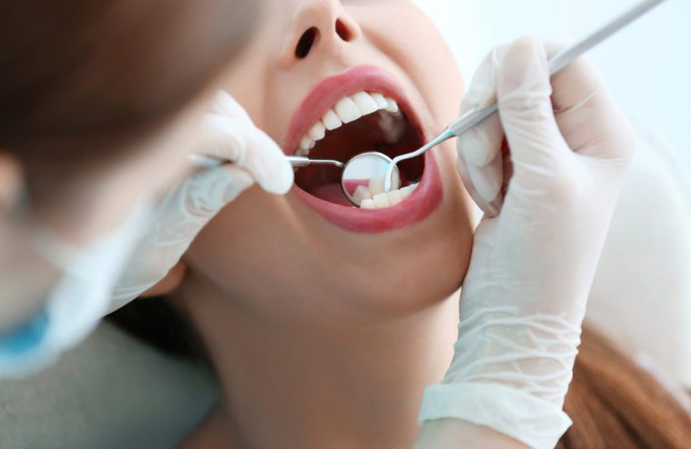 Dental fillings