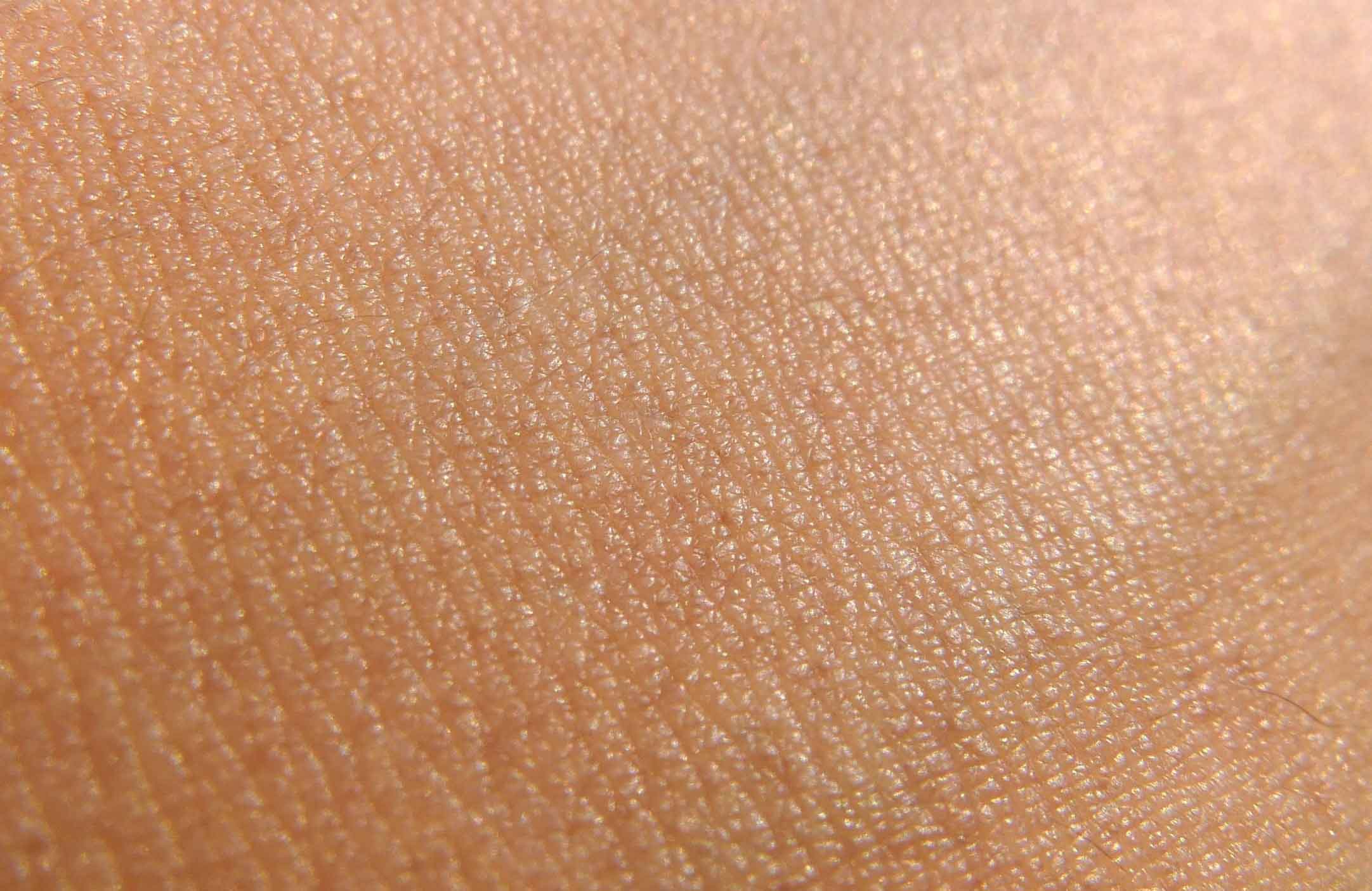 Your skin looks yellow