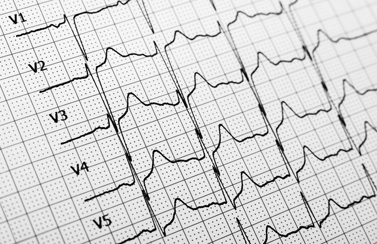 20 minutes later: Cardiovascular improvements