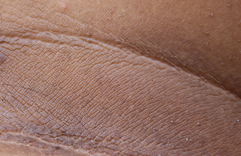 You have dark areas on your skin