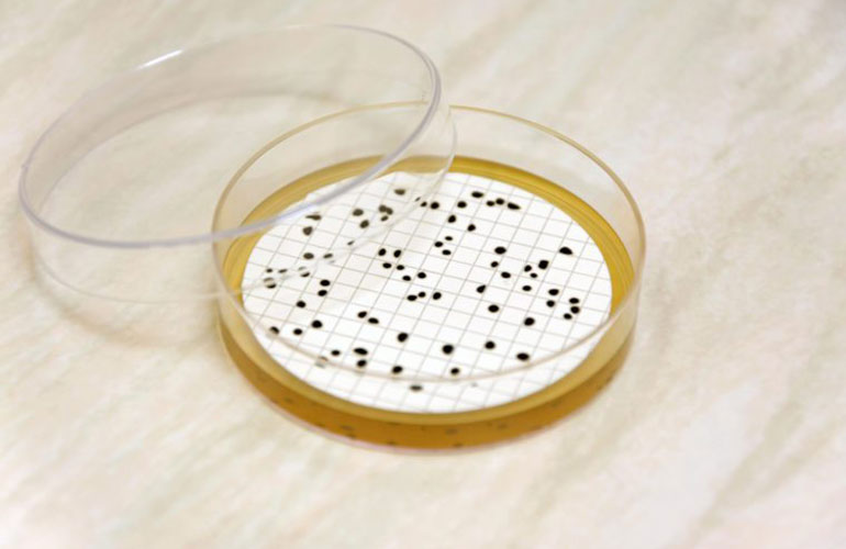 Bacteria