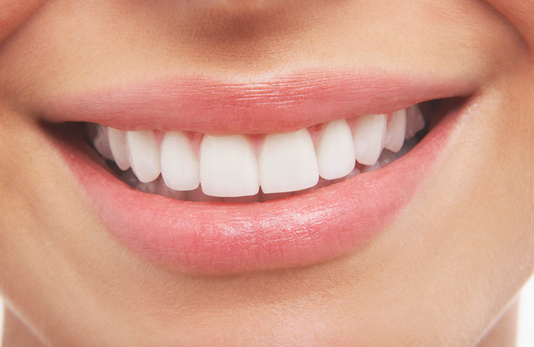 Turbo-charge your teeth whitening