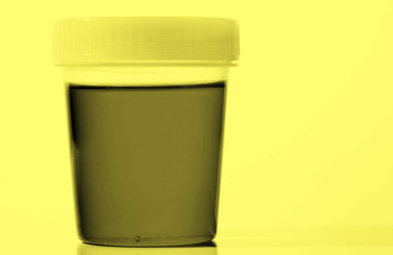 Urine
