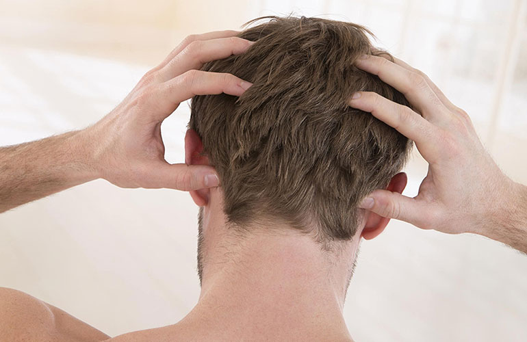 Calm an itchy or sensitive scalp