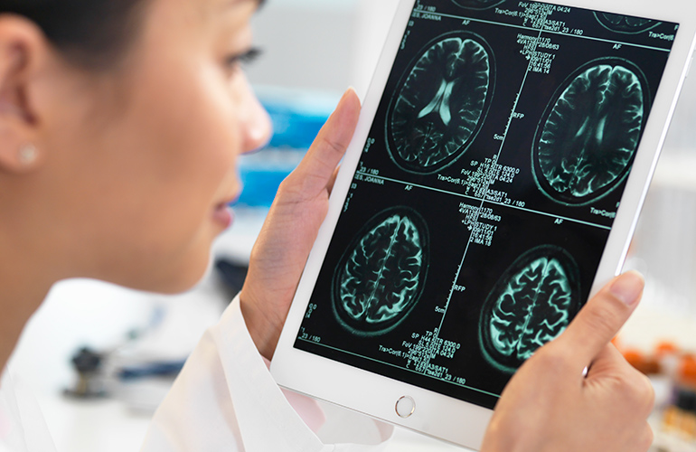 Symptoms of early-onset Alzheimer’s disease