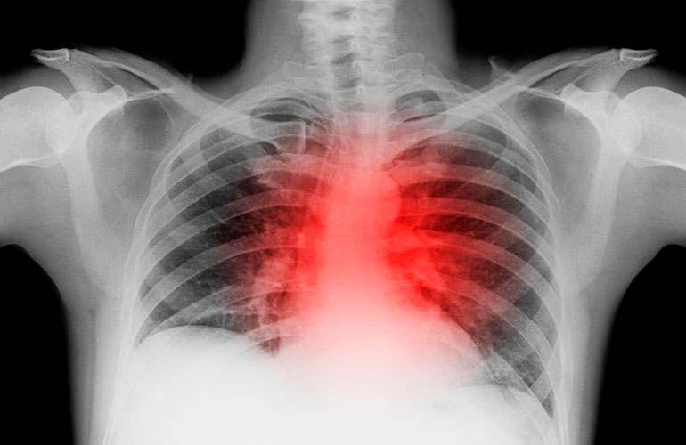 Vaping may increase your risk of heart disease