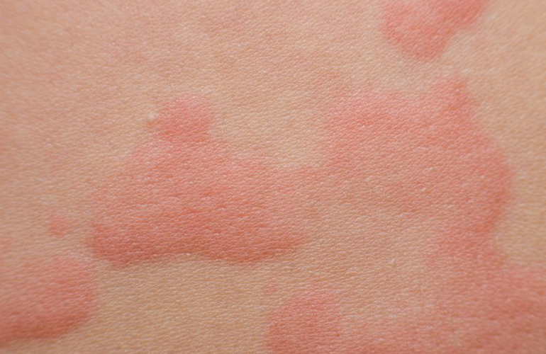 You’ve developed a weird rash