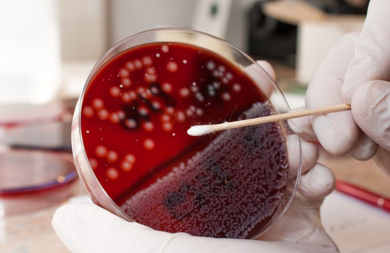 Non-O type: an increased risk of gastric cancer