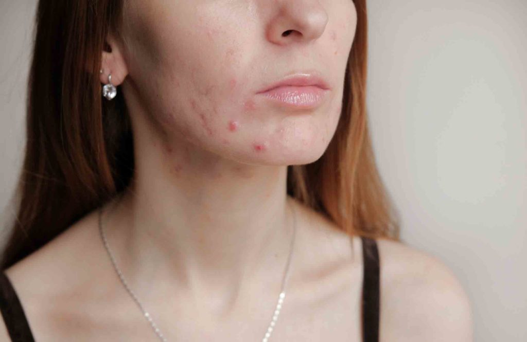 You have skin problems