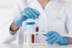 9 secrets your blood type reveals about you