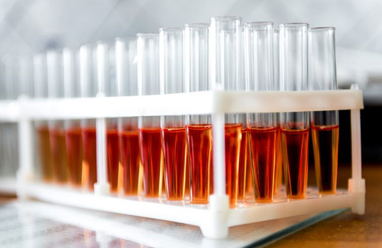 You don’t have to overhaul your life because of your blood type