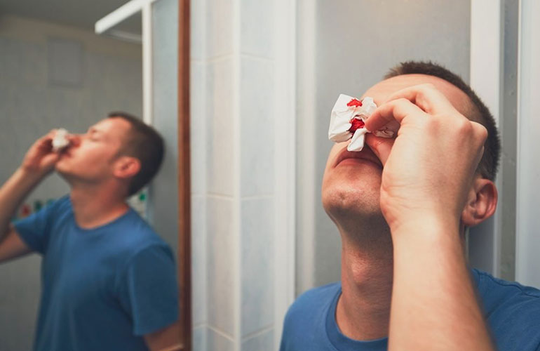 Tipping your head back during a nosebleed