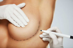 8 things I wish I’d known before getting a breast reduction