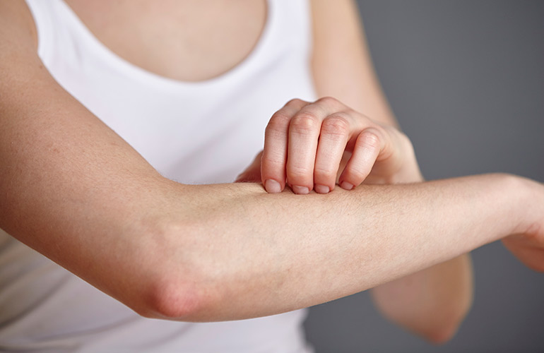 Giving antihistamine for a severe allergic reaction