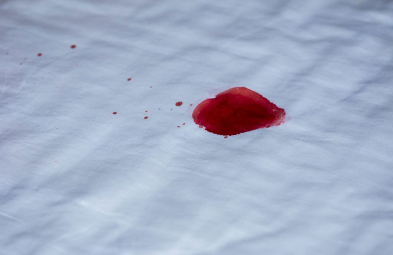 Unexplained bleeding