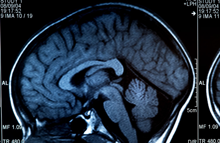 Improved brain function